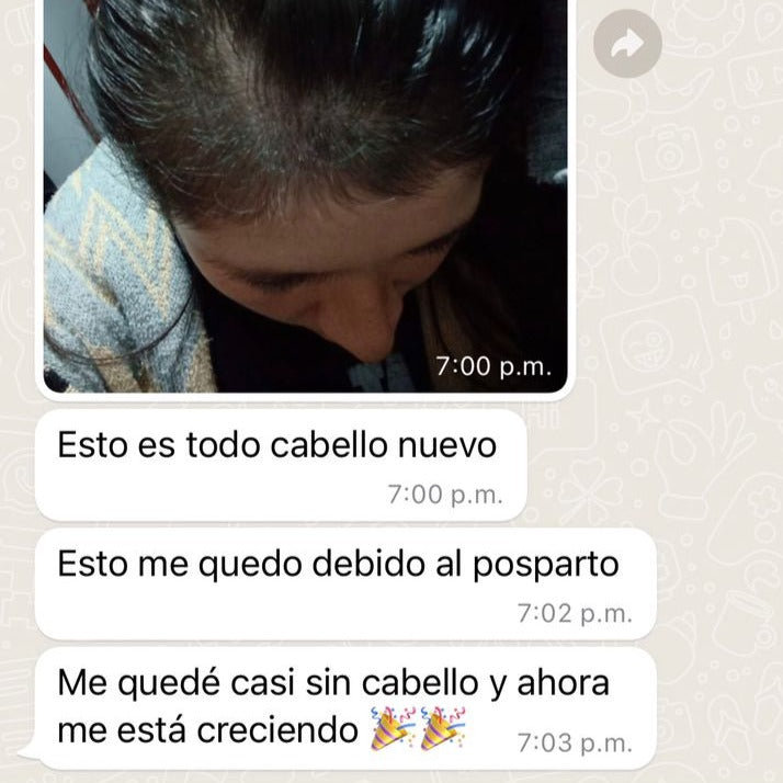 Shampoo Anti-Caida + Loción capilar con minoxidil + Tratamiento nutritivo + Serum Termoprotector