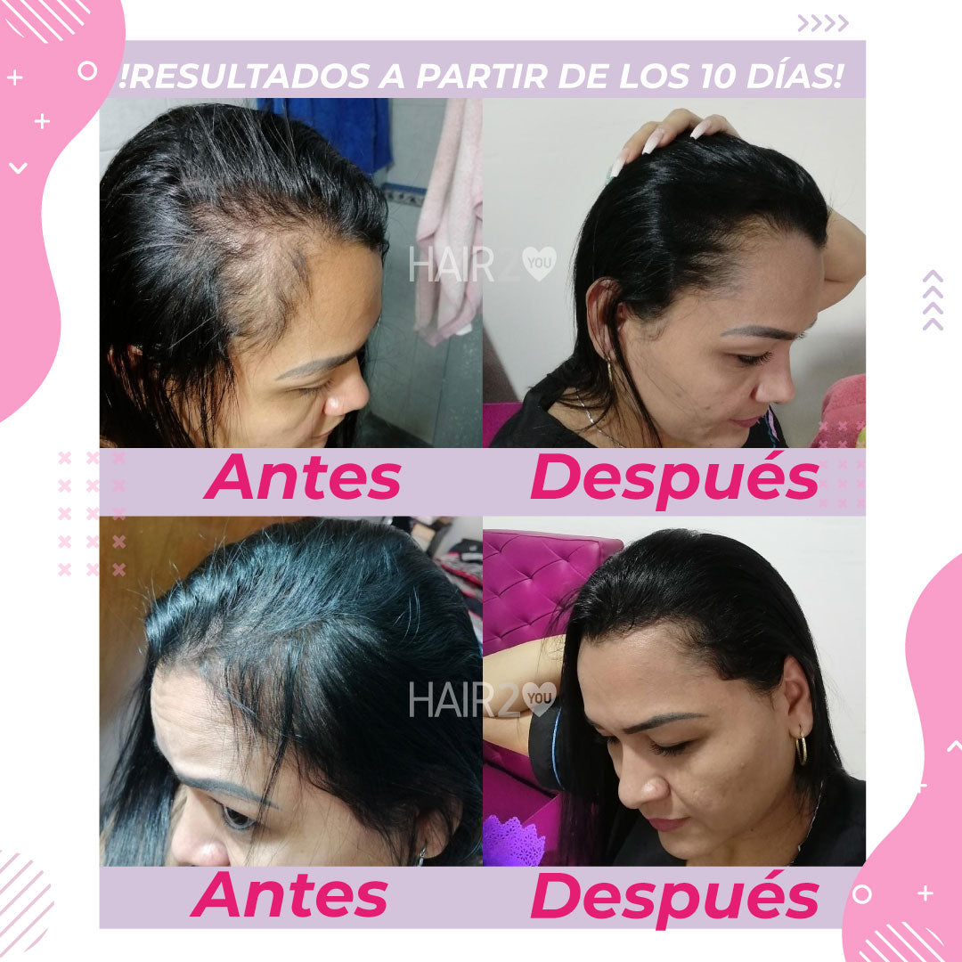 3 Frascos Vitaminas – GRATIS Shampoo Anti caída y Tratamiento nutritivo