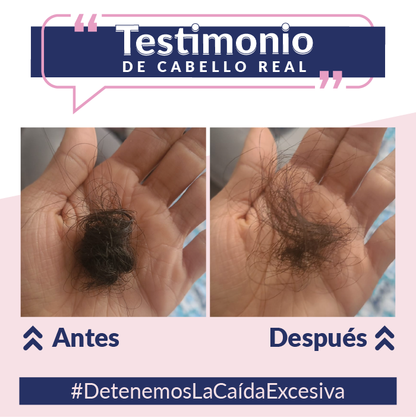 Caída del cabello, anticaída, detiene la caída del cabello, crecimiento del cabello