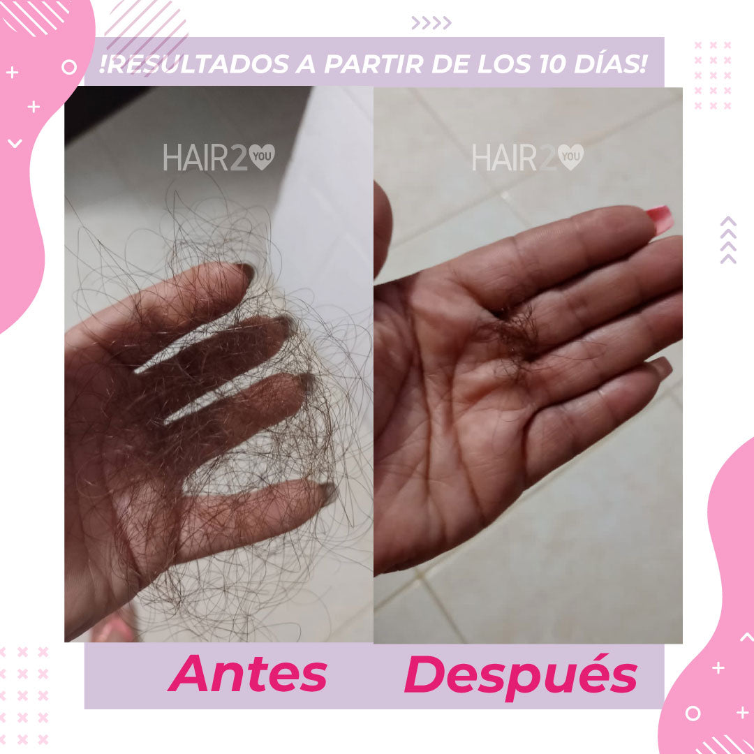 - Vitaminas Tuyú + Shampoo Resistencia + Loción capilar