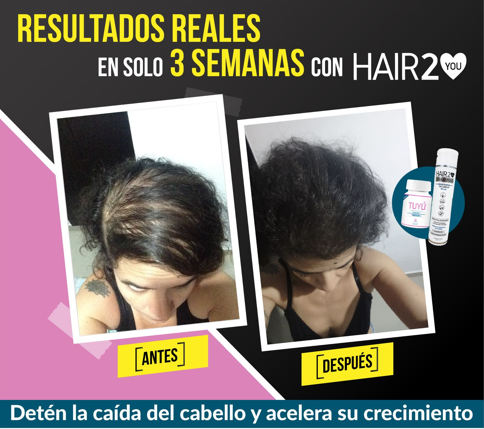 Membresía - Tratamiento Anticaída completo por 1 mes