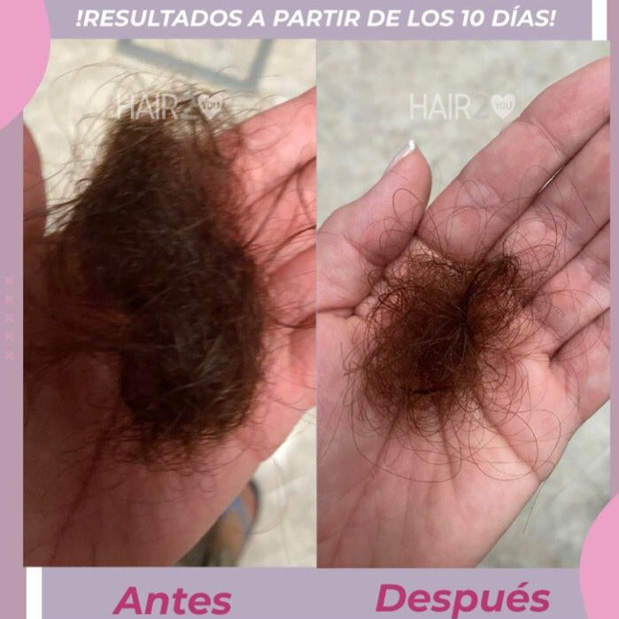 - Vitaminas + Shampoo Resistencia + Loción capilar + Tratamiento nutritivo