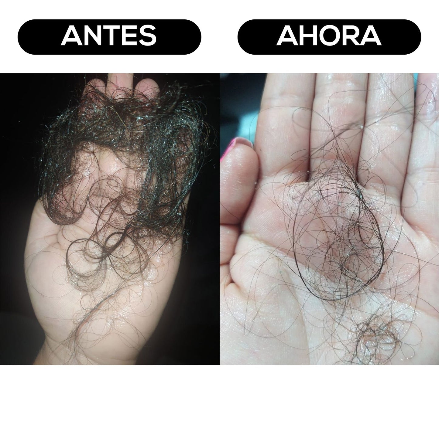 Rutina Anticaída Avanzada - Paga 2 y Lleva 3