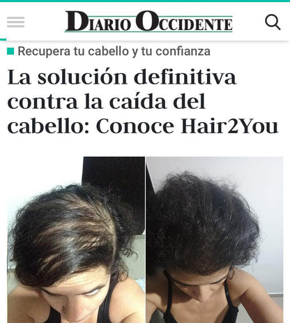 - Vitaminas + Shampoo Resistencia + Loción capilar + Tratamiento nutritivo