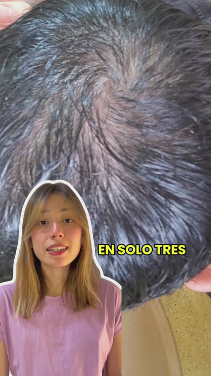 Paga 2, Lleva 3 – Shots de Crecimiento