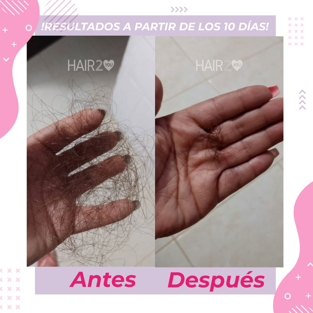 2 Frascos Vitaminas – GRATIS Shampoo Anti caída Sin sal